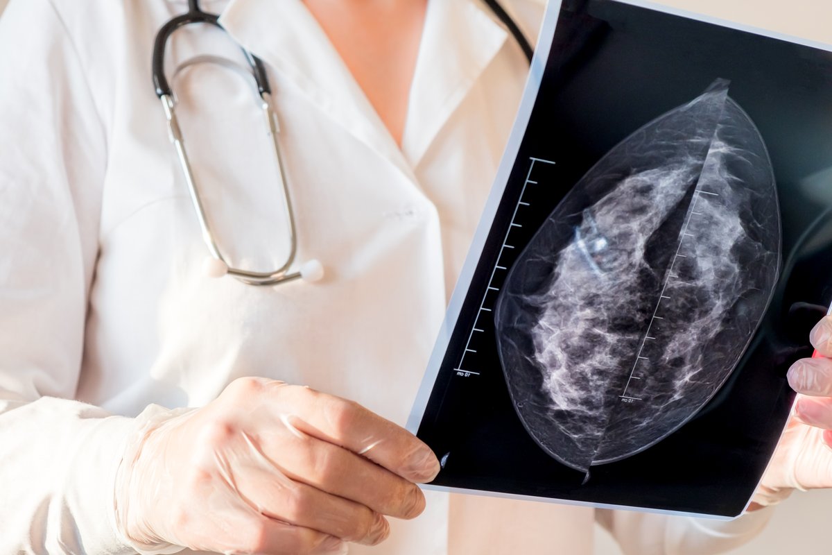 Enfermedades que detecta la mamografía